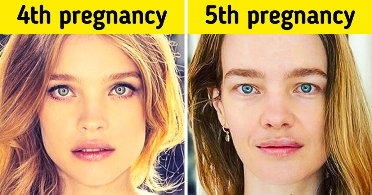 9-strange-but-very-true-facts-about-pregnancy-that-doctors-rarely-talk