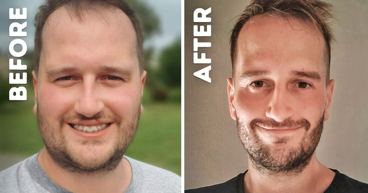 A Man Managed to Lose 126 Pounds in a Year and Told Us How He Did It (No Strict Diets Required)