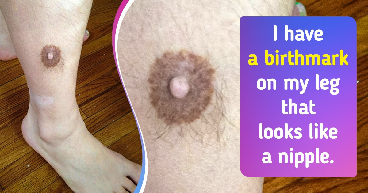 15 Times Genes Got Creative and Gave People and Animals Special Features
