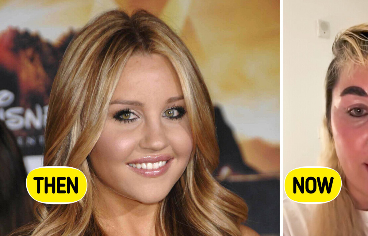 Amanda Bynes’ Drastic New Look Leaves Fans Worried Amanda Bynes’ Drastic New Look Leaves Fans Worried