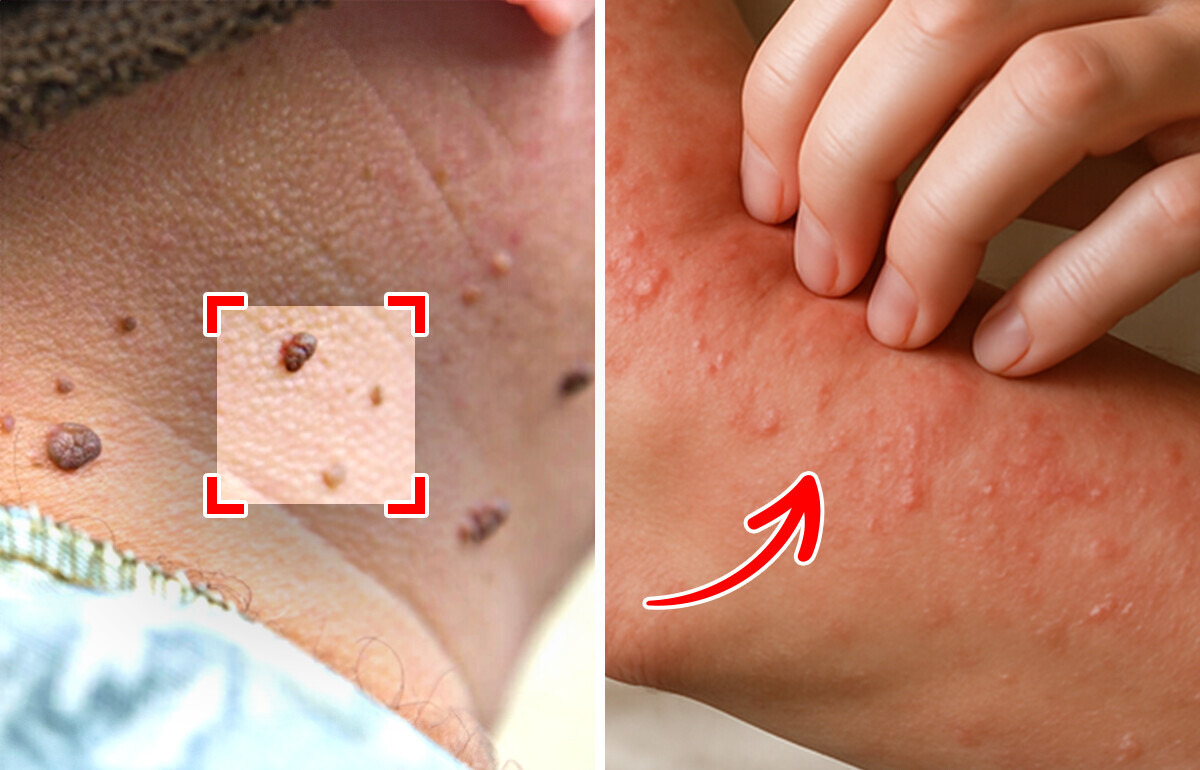 6 Sneaky Diabetes Symptoms You Might Miss 6 Sneaky Diabetes Symptoms You Might Miss