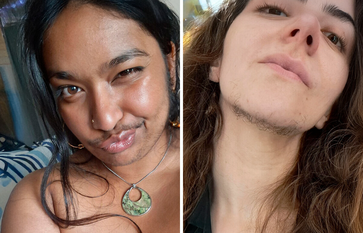 13 Women Who Proudly Let Their Body Hair Steal the Show 13 Women Who Proudly Let Their Body Hair Steal the Show