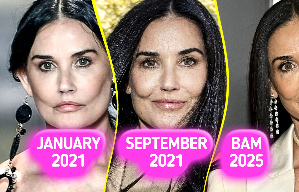 Experts Uncover What Really Changed Demi Moore’s Face Experts Uncover What Really Changed Demi Moore’s Face