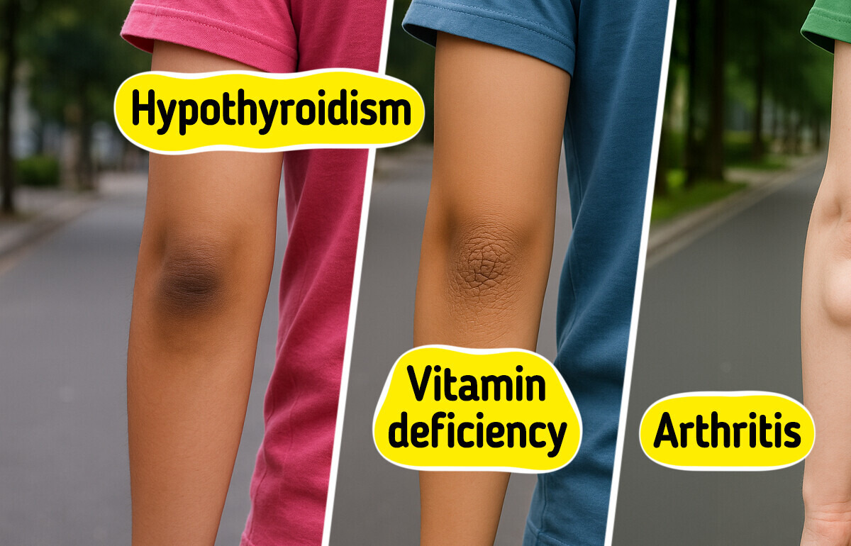 10 Common Elbow Skin Issues That Could Reflect Underlying Health Problems