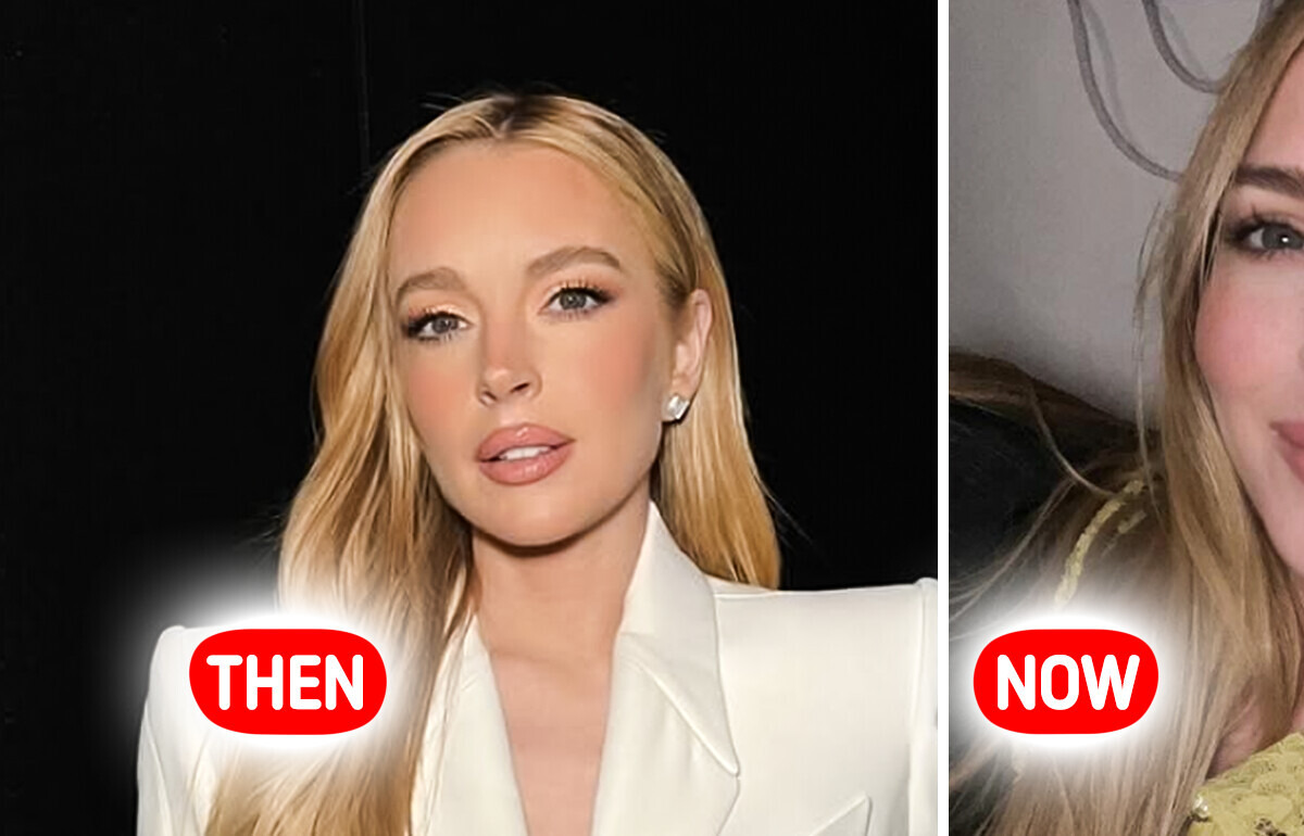 “Face Transplant,” Lindsay Lohan’s Latest Photo Causes Major Stir—People Notice One Detail