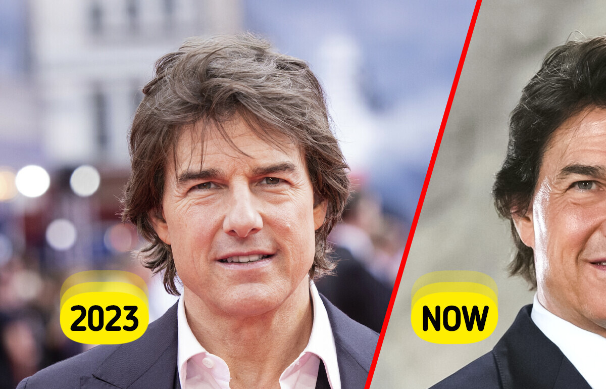 What Might Have Happened to Tom Cruise’s Face, According to Doctors