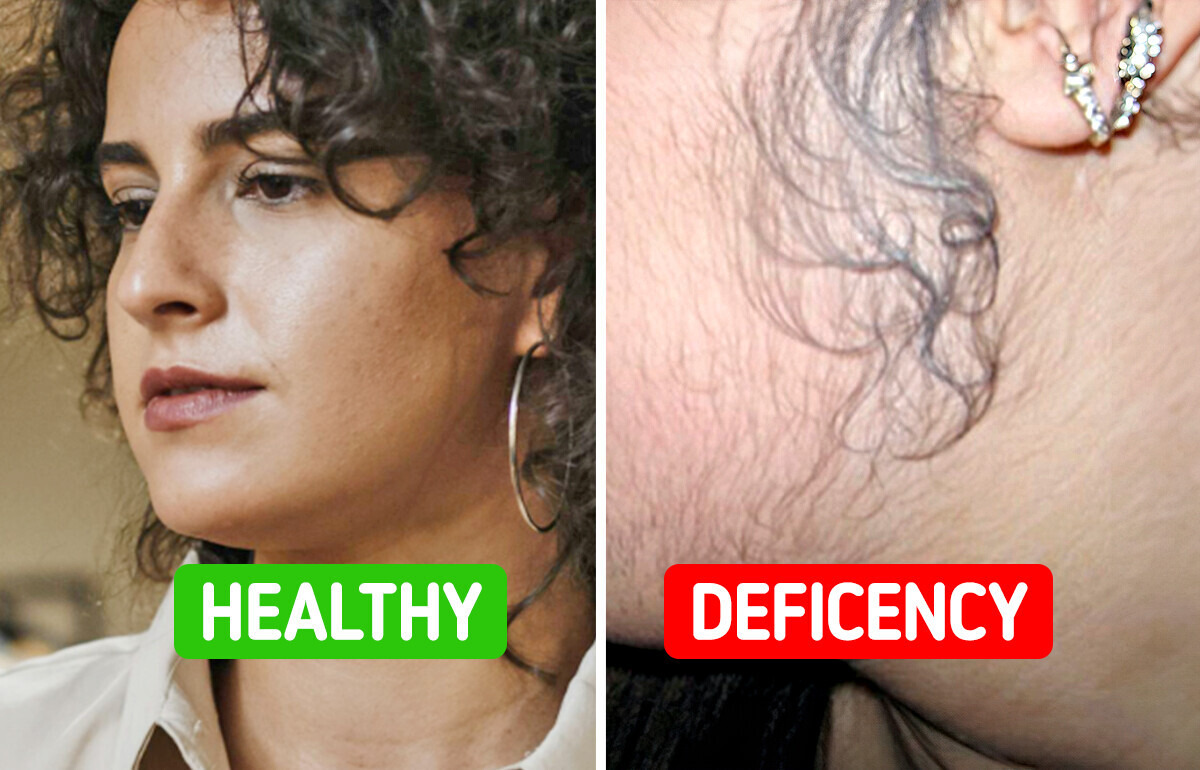 5 Signs That Your Body Might Be Running Short of Vitamin D