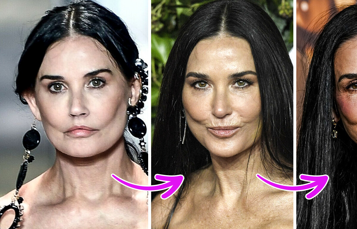 Experts Explain the Mystery of What Might Have Happened to Demi Moore’s Face Experts Explain the Mystery of What Might Have Happened to Demi Moore’s Face