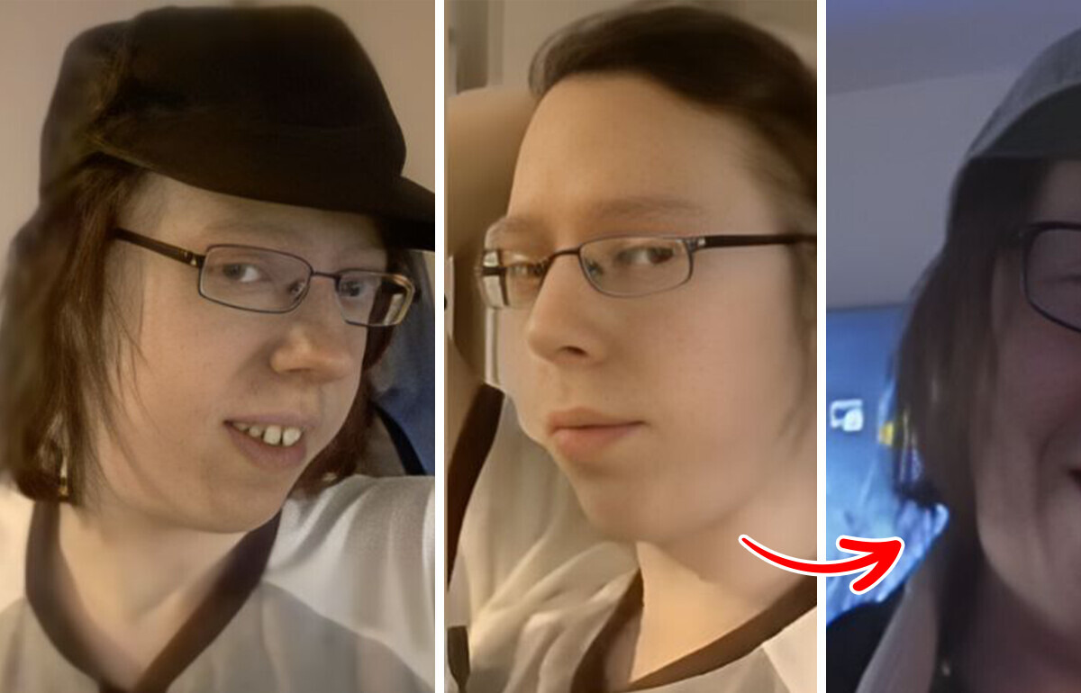 Man Shares a Heartbreaking Video About Being Ugly and It Changes His Life Forever