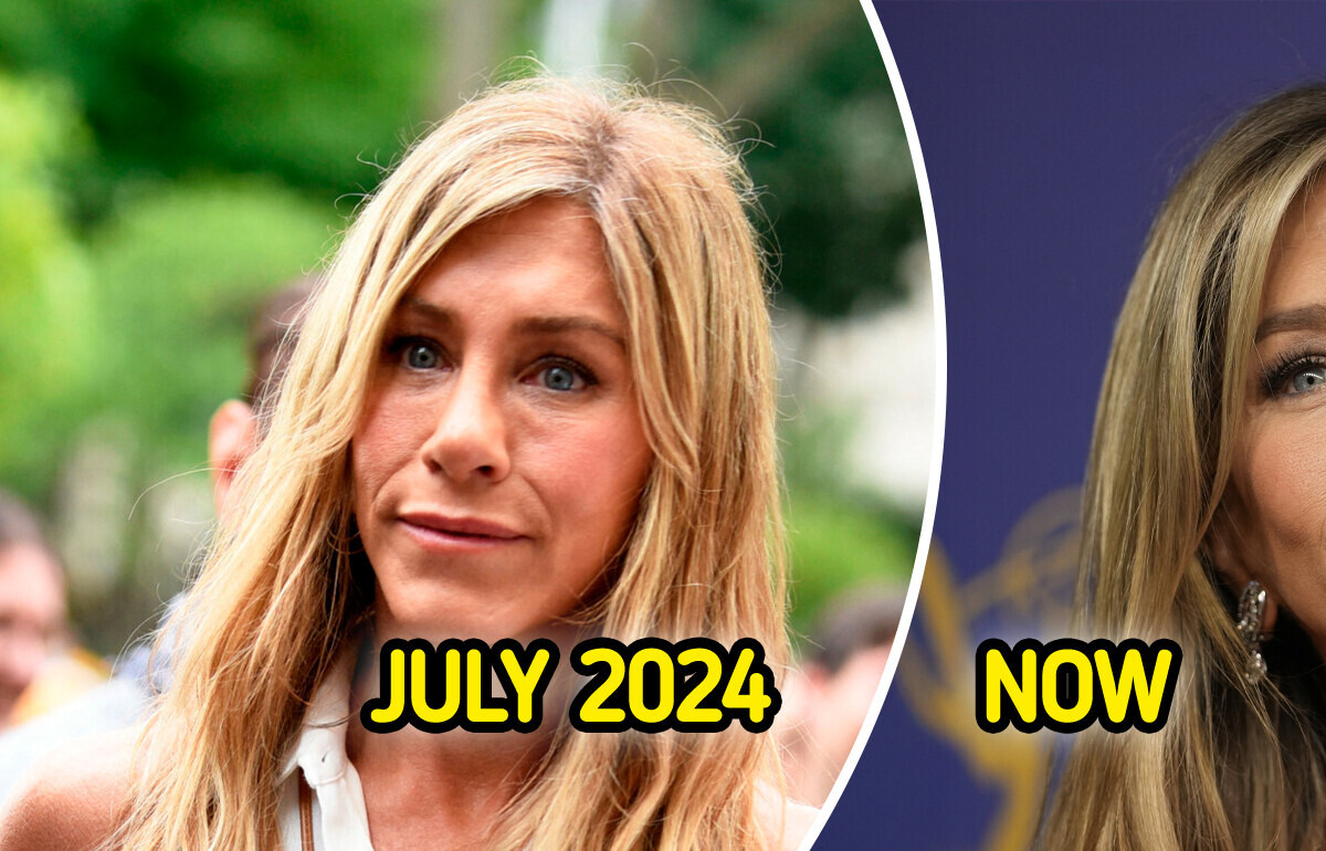 Jennifer Aniston Ditches Fillers, Sparks Public Reaction