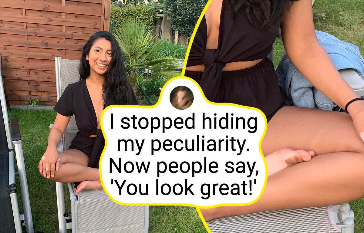 13 Times When Nature Gave People Unique Features