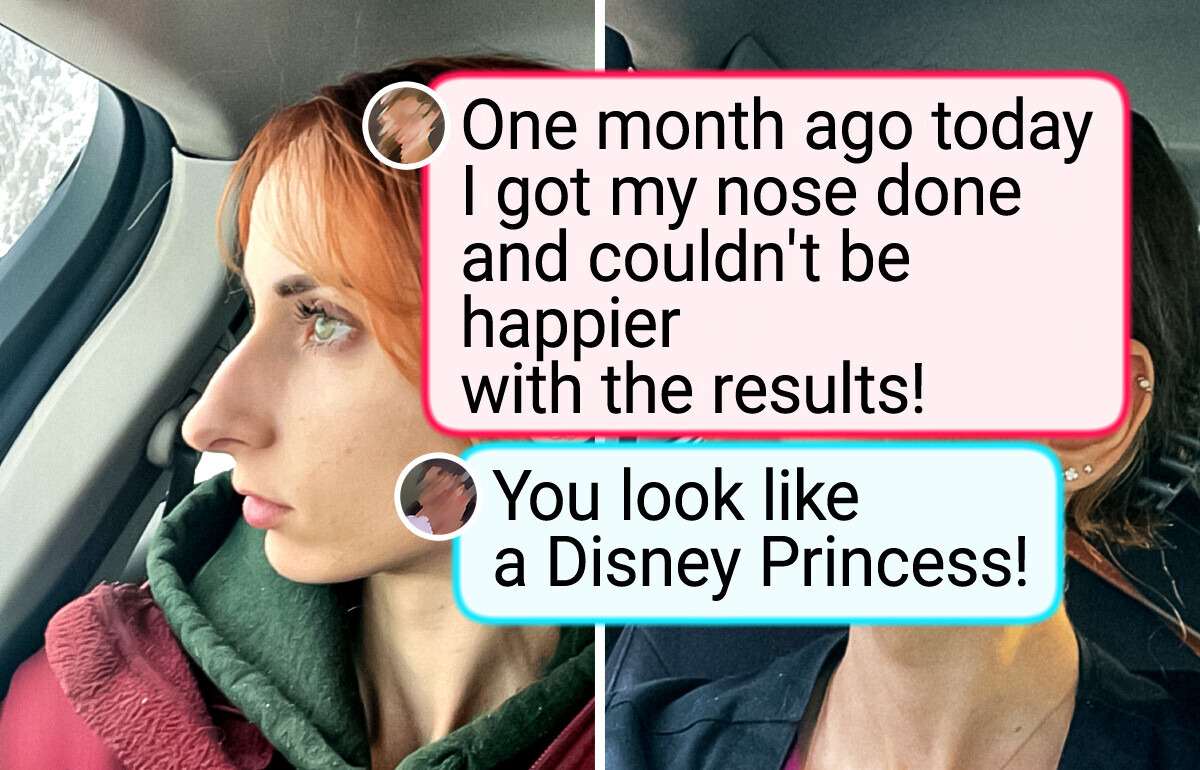 13 Before-and-After Photos That Tell a Whole Story 13 Before-and-After Photos That Tell a Whole Story