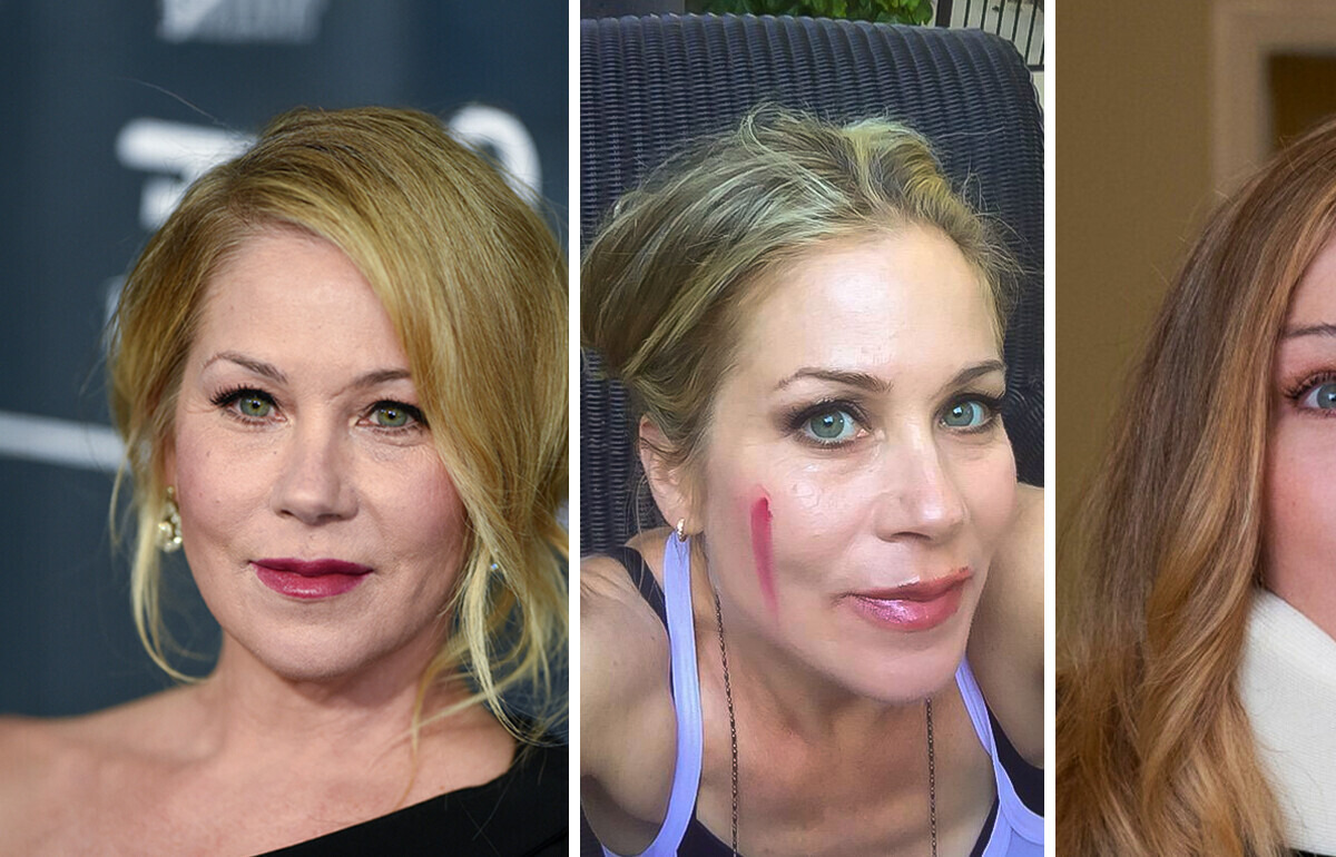 The Real Reason Christina Applegate Was Hospitalized 30 Times Amid Her MS Struggle The Real Reason Christina Applegate Was Hospitalized 30 Times Amid Her MS Struggle