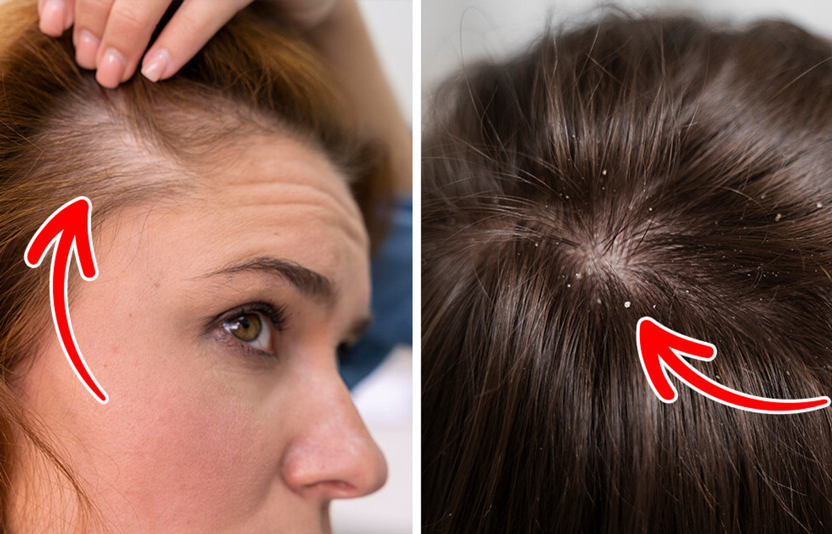 7 Health Signs Your Hair Might Reveal About Your Health 7 Health Signs Your Hair Might Reveal About Your Health