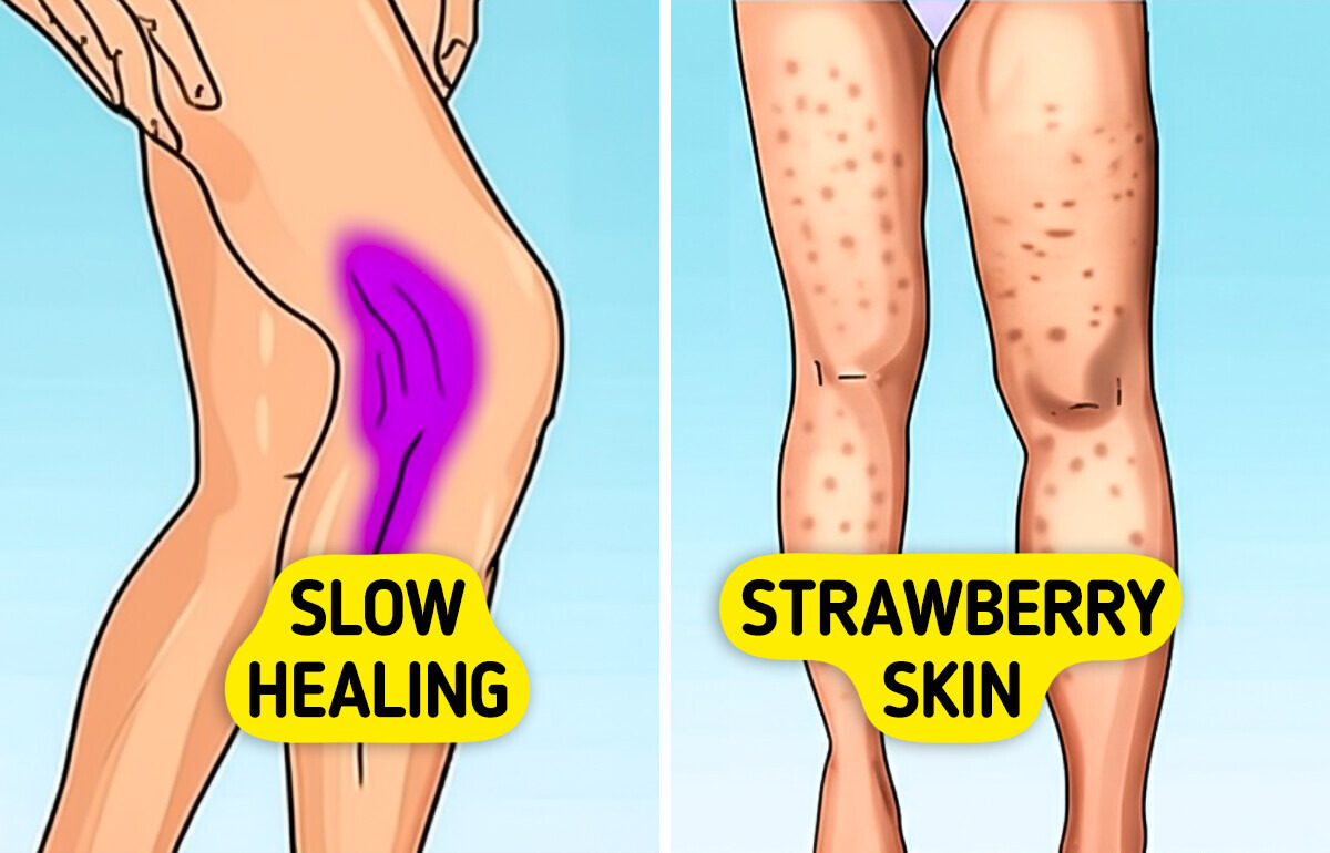 7 Signs Your Body Can Give You When You're Low on Collagen