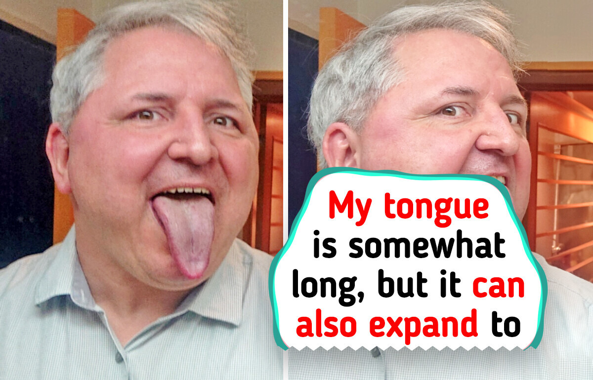 15 Unusual Human Body Features That Make Their Owners Unique