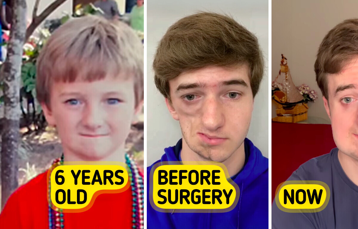 A Young Man’s Rare Condition Made Him an Unexpected Hero Online