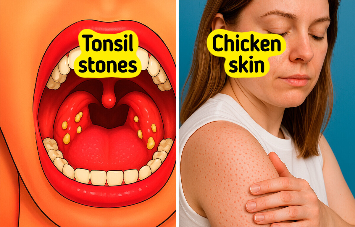 14 Signs Your Body Might Be Sensitive to Gluten