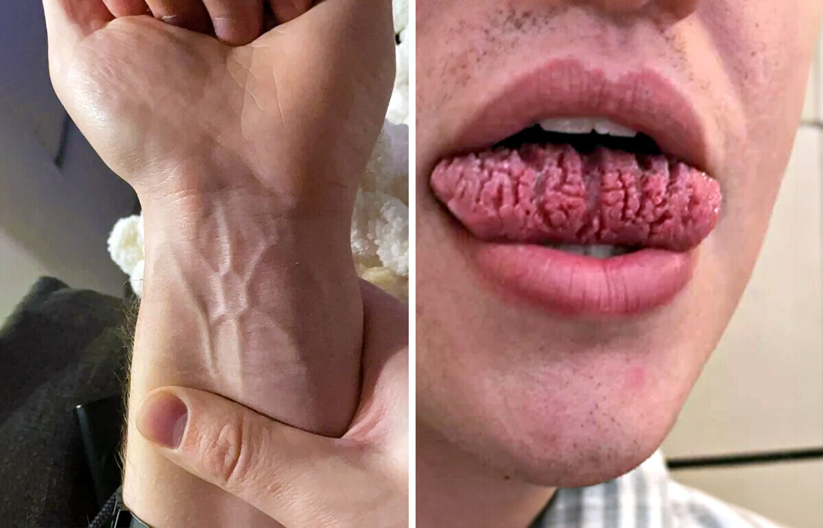 18 Times Genetics Gave People Something Truly One of a Kind
