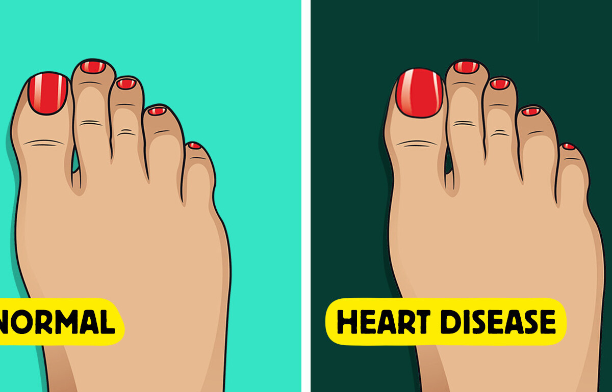 5 Health Signs Your Toenails Might Reveal About Your Body