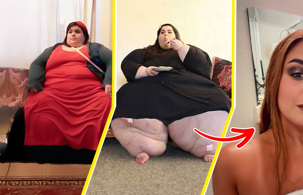 “My 600-lb Life” Star Amber Rachdi Stuns With 377-Lb Weight Loss, Becomes a Living Legend