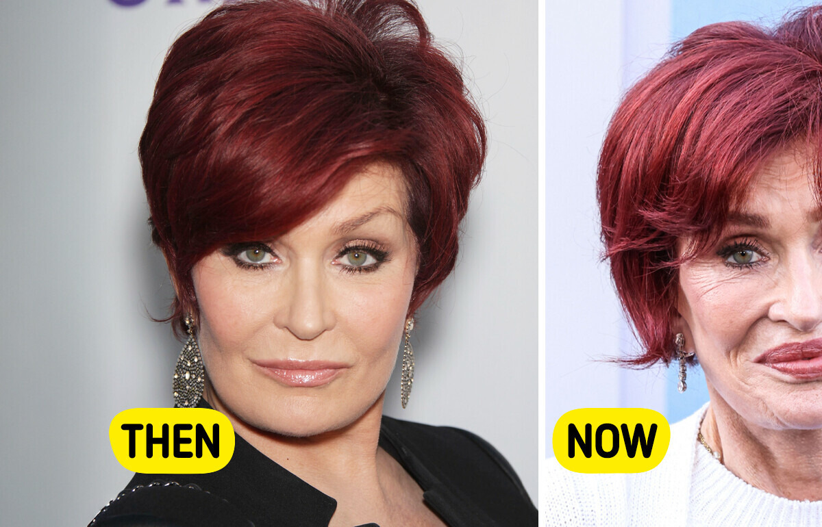 “I Think I Went Too Far,” Sharon Osbourne (72) Finally Reveals the Truth About Her Transformation “I Think I Went Too Far,” Sharon Osbourne (72) Finally Reveals the Truth About Her Transformation