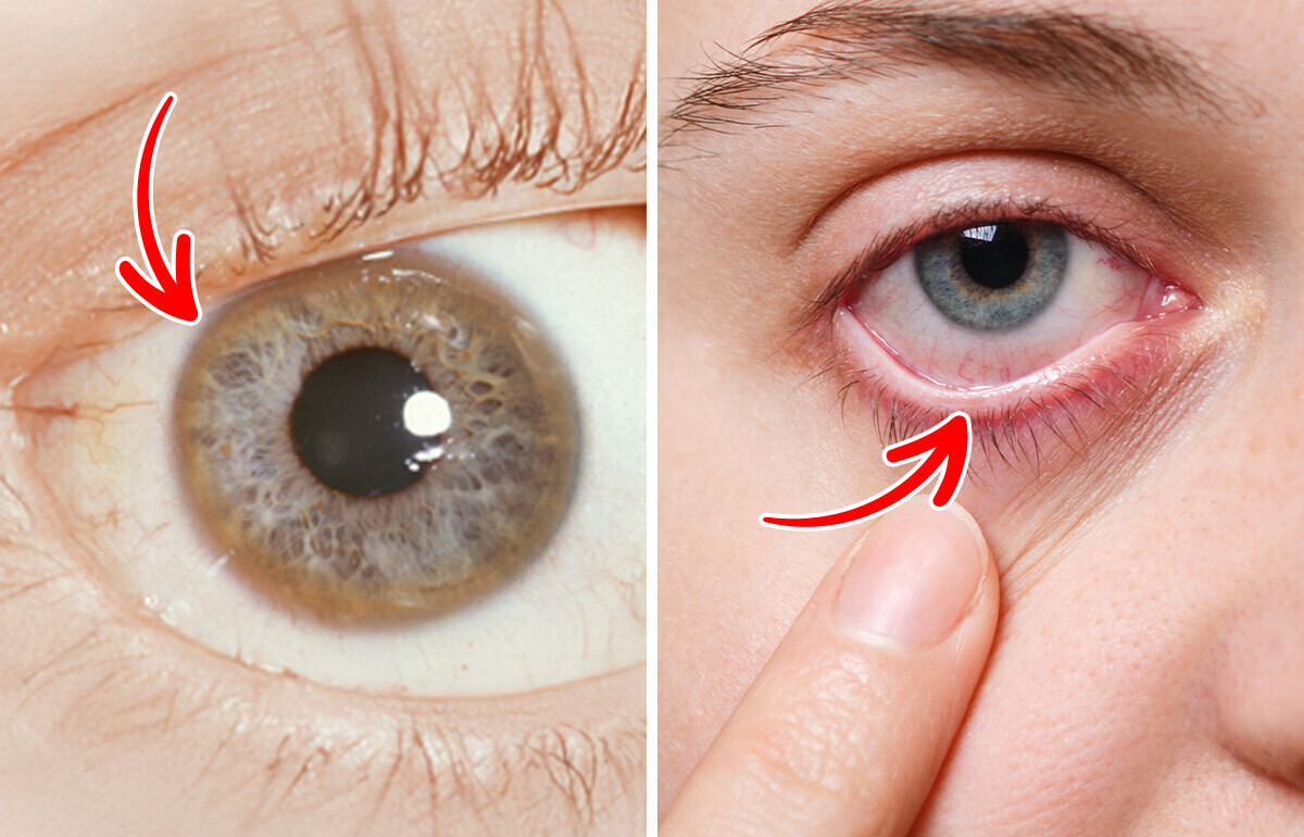 12 Unusual Eye Changes That Might Predict Serious Health Issues 12 Unusual Eye Changes That Might Predict Serious Health Issues