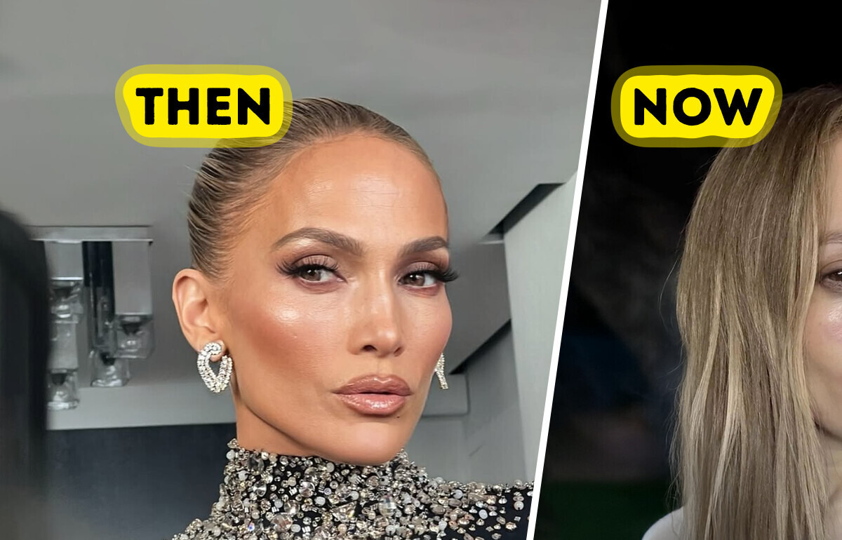 “So...This Happened,” Jennifer Lopez Posts Her Face Injury on Social Media, Shocking Fans “So...This Happened,” Jennifer Lopez Posts Her Face Injury on Social Media, Shocking Fans