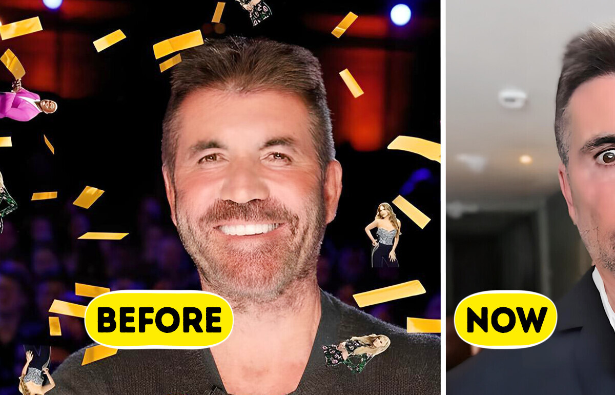 “What Happened to His Face?!” Simon Cowell’s Drastic New Look Leaves Fans Worried “What Happened to His Face?!” Simon Cowell’s Drastic New Look Leaves Fans Worried