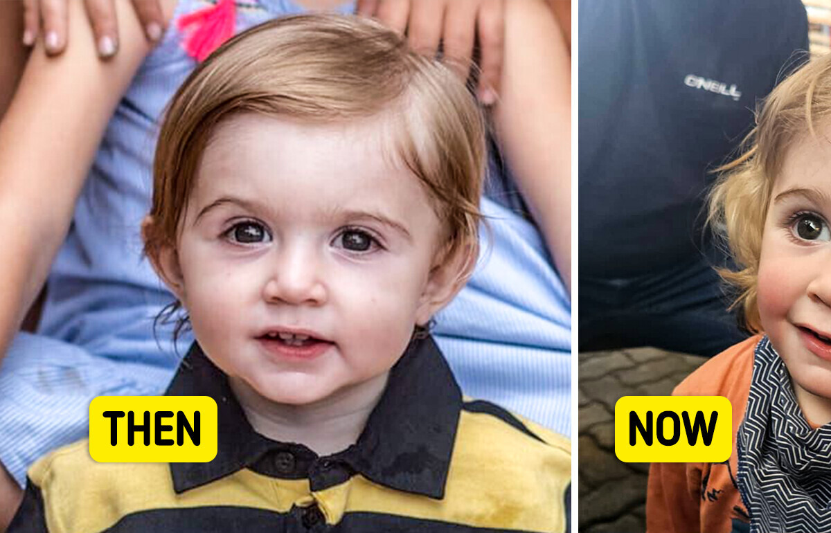 "Never Kiss Someone's Baby!" Mom Urgently Warns People While Doctors Are Fighting to Save Her Baby's Eye