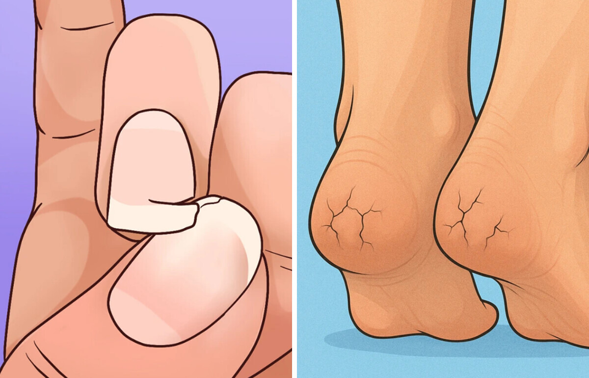 12 Unexpected Signs You Might Be Intolerant to Dairy 12 Unexpected Signs You Might Be Intolerant to Dairy