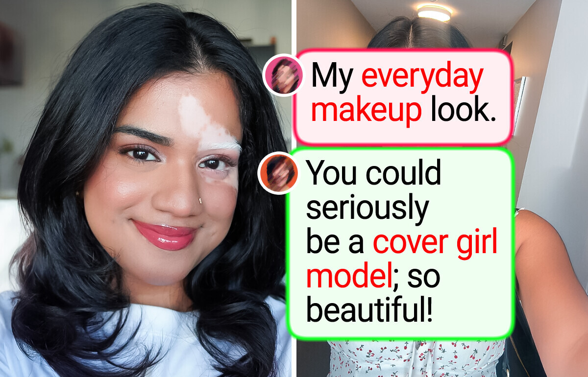 20 People Who Stand Out From the Crowd for a Beautiful Reason