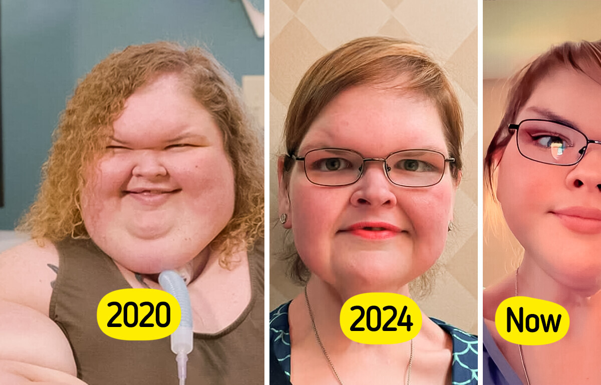“1000-lb Sisters” Star Debuts a New Look After Skin Removal Surgery, Leaves Fans Shocked
