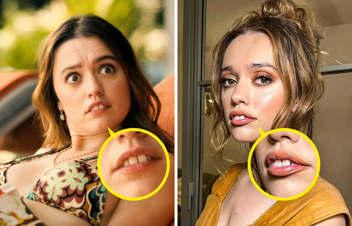 White Lotus’ Star Aimee Lou Wood Brings Back "Normal" Teeth, and Fans Love It