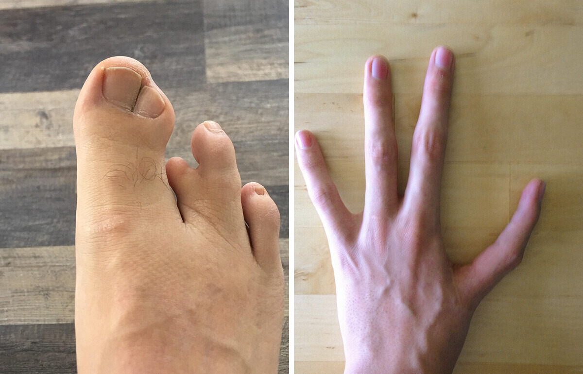 15 Mysterious Things That Happened to Real People’s Bodies