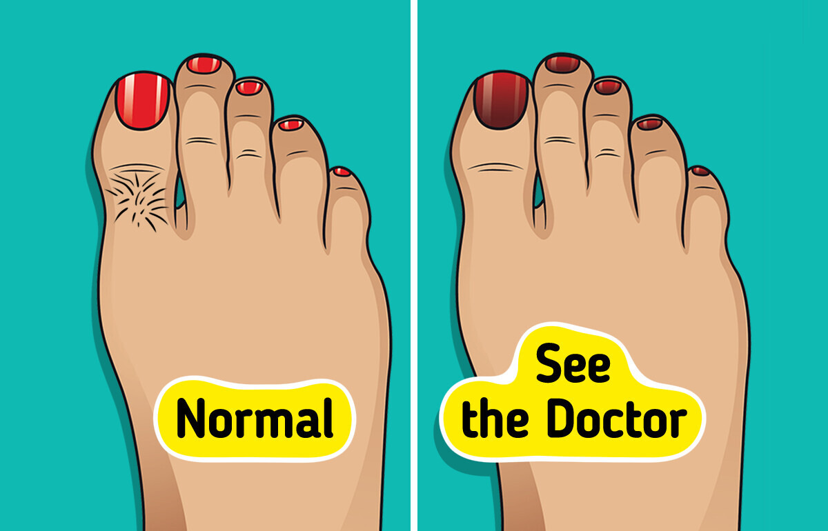 9 Things Your Feet Can Reveal About Your Health (That You Shouldn’t Ignore)