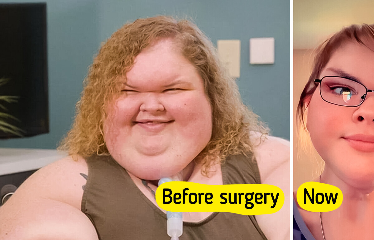 “Proud of You,” 1000lb Sisters Star’s Incredible Before and After Skin(02)