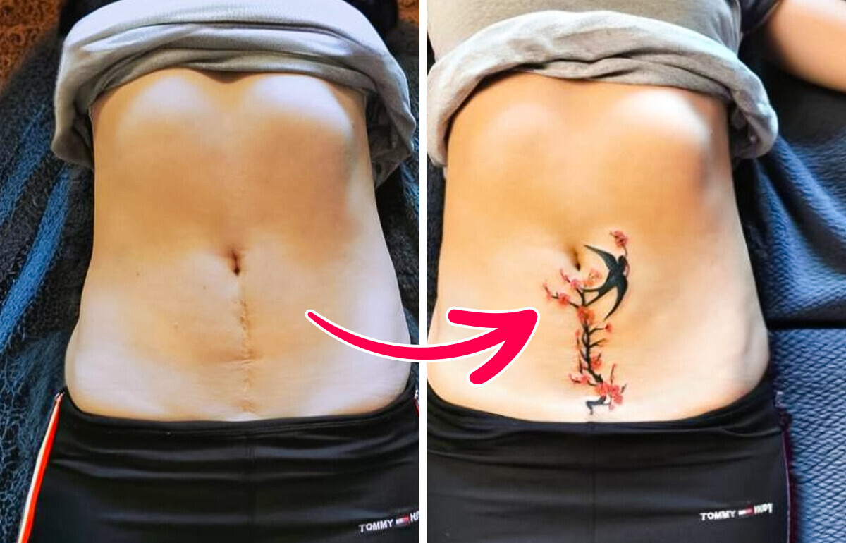 16 Tattoo Artists Who Transformed People’s Scars Into Outstanding Tattoos 16 Tattoo Artists Who Transformed People’s Scars Into Outstanding Tattoos