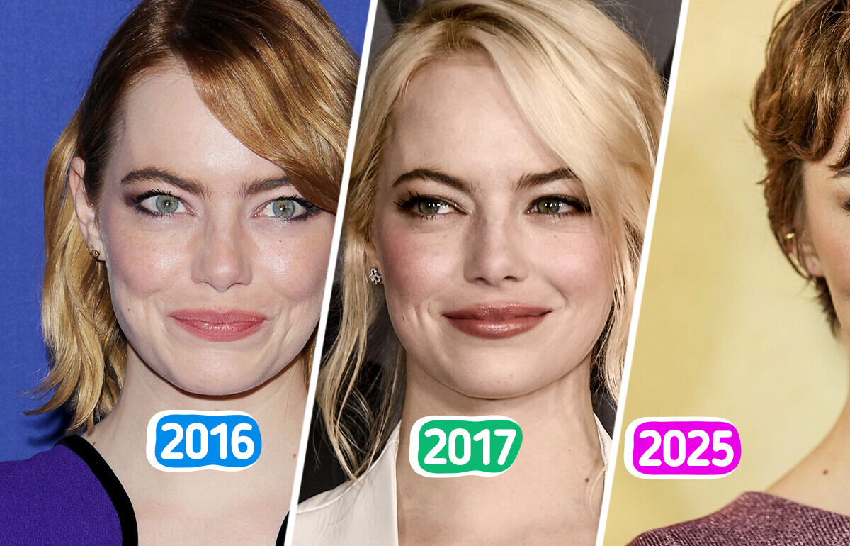 Fans Notice Emma Stone Looks Almost Unrecognizable: “Someone Photoshopped Margot Robbie’s Face” Fans Notice Emma Stone Looks Almost Unrecognizable: “Someone Photoshopped Margot Robbie’s Face”