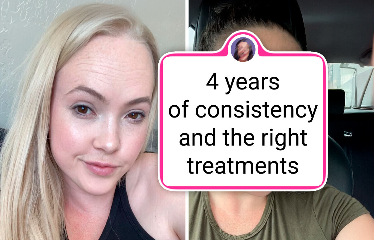 14 People Who Completely Reinvented Themselves