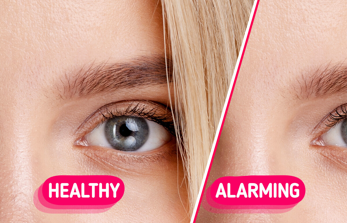 5 Subtle Clues That Could Reveal Hidden Health Problems 5 Subtle Clues That Could Reveal Hidden Health Problems