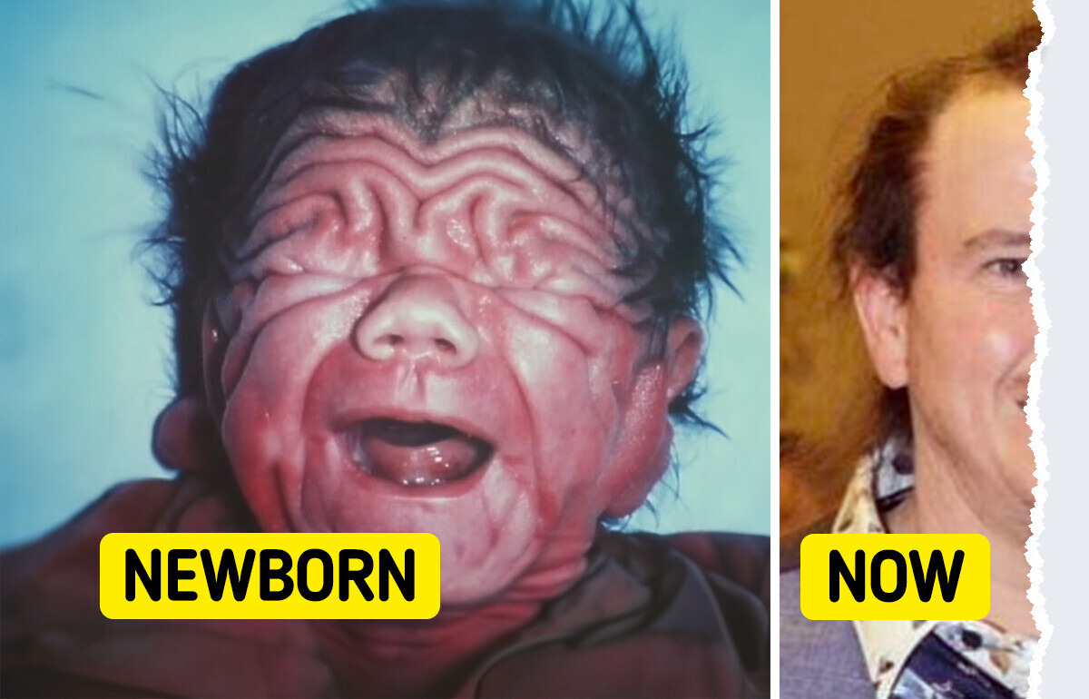 The Story of the Baby That Defied All Odds The Story of the Baby That Defied All Odds