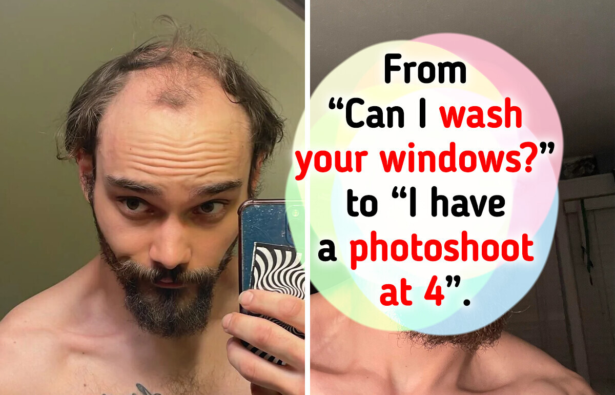 12 Guys Who Embraced Their Baldness—And Got Even More Attractive 12 Guys Who Embraced Their Baldness—And Got Even More Attractive