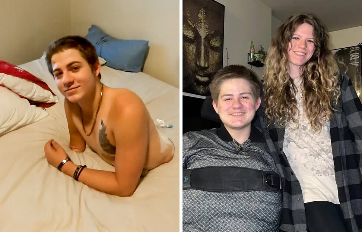 He Was Cut in Half by a Forklift, Now He Is an Inspiration to Many People