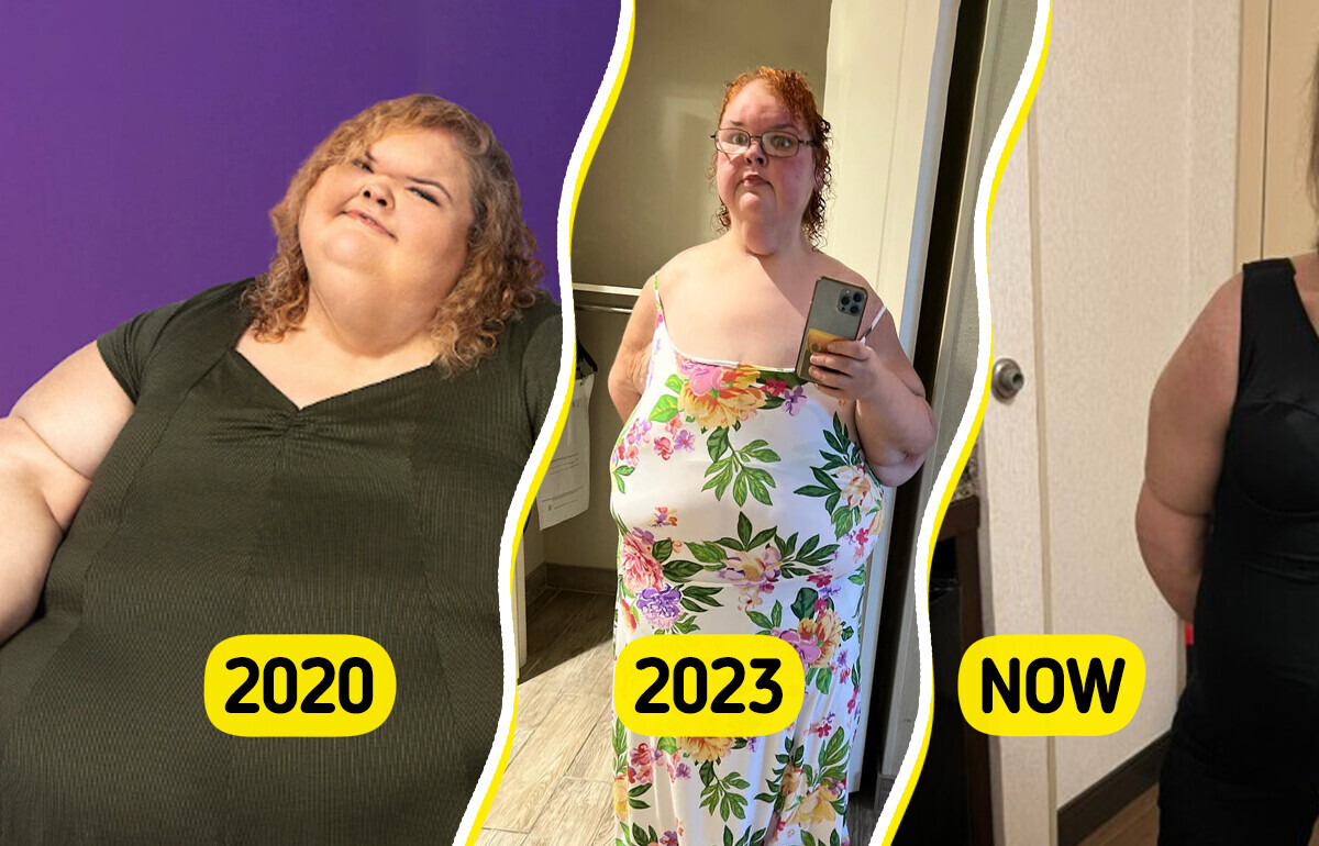 “1000-lb Sisters” Star Shows Off Her New Body in a Swimsuit After Skin Removal Surgery “1000-lb Sisters” Star Shows Off Her New Body in a Swimsuit After Skin Removal Surgery
