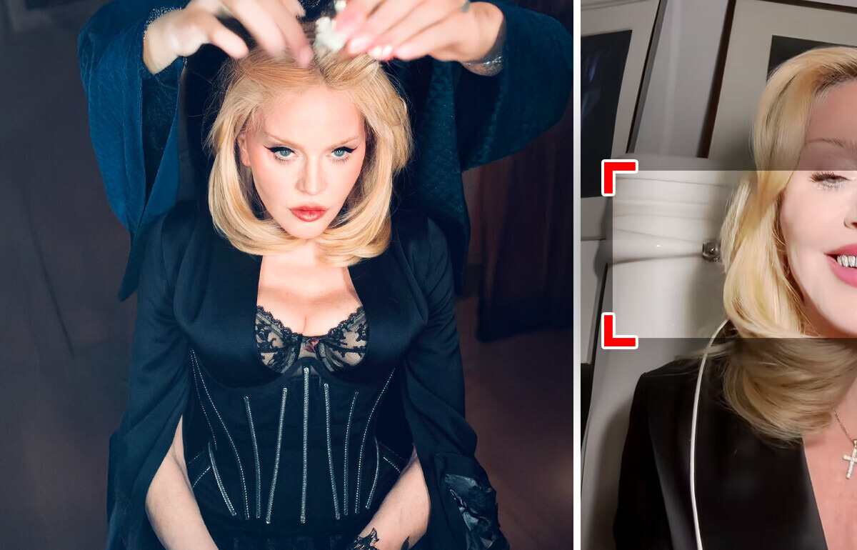Madonna Shows Off Her New Teeth and People Notice the Same Thing