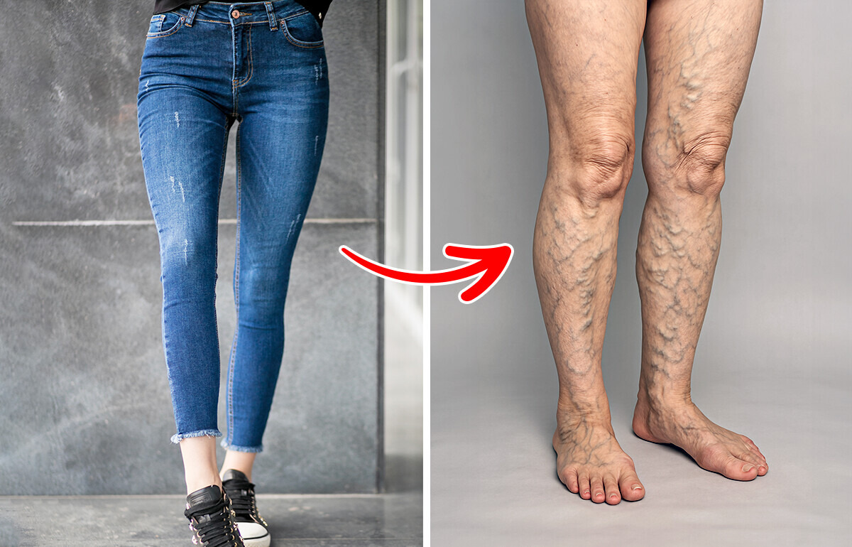 8 Reasons to Avoid Tight Clothing for a Healthier Body