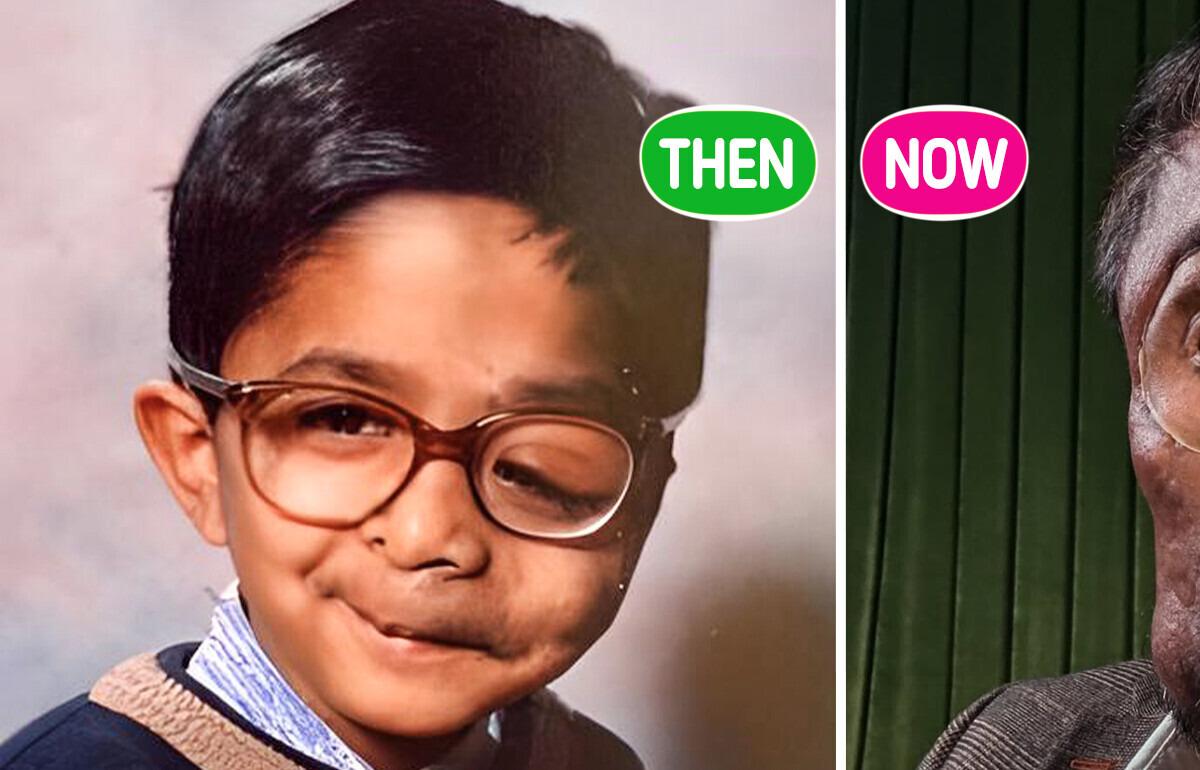 A Man Was Refused Service in a Café Due to His Disfigurement—But Nothing Can Steal His Confidence A Man Was Refused Service in a Café Due to His Disfigurement—But Nothing Can Steal His Confidence