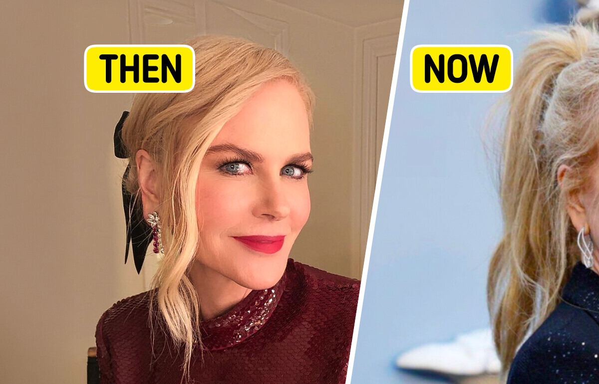 “Facelift Indicators Near Her Ears,” Nicole Kidman Shocks With Her Latest Transformation—People Notice One Detail