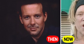 Mickey Rourke’s Drastic Transformation Barely Reminds Fans of His Younger Version